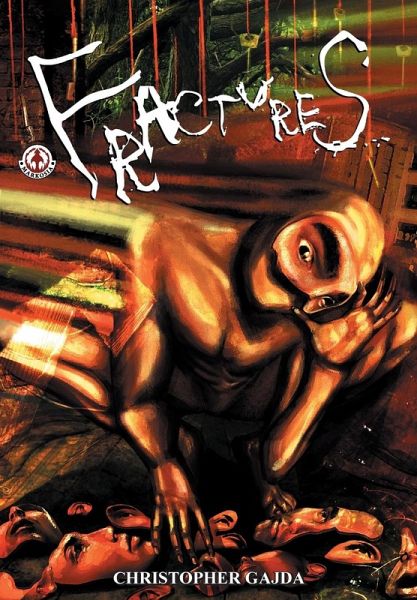 Fractures Fractures