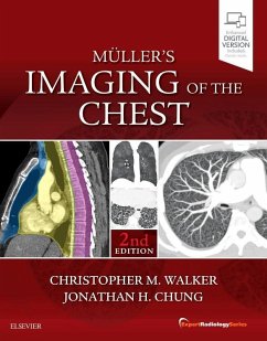 Muller's Imaging of the Chest - Walker, Christopher M.;Chung, Jonathan H.