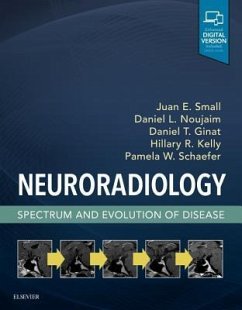 Neuroradiology: Spectrum and Evolution of Disease - Small, Juan E; Noujaim, Daniel L; Ginat, Daniel T; Kelly, Hillary R; Schaefer, Pamela W Neuroradiology: Spectrum and Evolution of Disease - Small, Juan E; Noujaim, Daniel L; Ginat, Daniel T; Kelly, Hillary R; Schaefer, Pamela W
