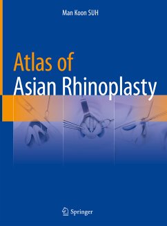 Atlas of Asian Rhinoplasty (eBook, PDF) - Suh, Man Koon