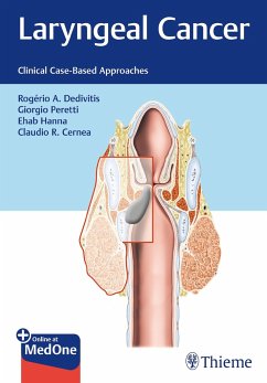 Laryngeal Cancer - Dedivitis, Rogério A.;Peretti, Giorgio;Cernea, Claudio R.