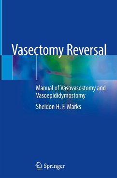 Vasectomy Reversal - Marks, Sheldon H.F.