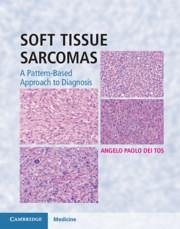 Soft Tissue Sarcomas Hardback with Online Resource - Dei Tos, Angelo Paolo