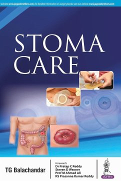 Stoma Care - Balachandar, Tg