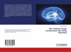 Bio-medical Image Compression By Using Wavelets