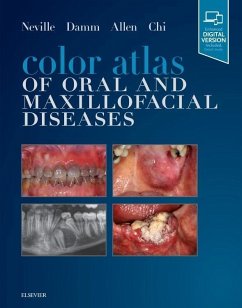 Color Atlas of Oral and Maxillofacial Diseases - Allen, Carl M.;Chi, Angela C.