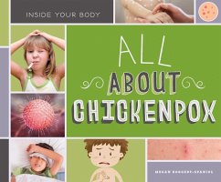 All about Chickenpox - Borgert-Spaniol, Megan