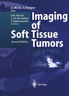 Imaging of Soft Tissue Tumors (eBook, PDF)