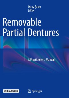 Removable Partial Dentures