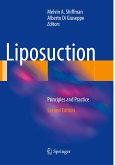 Liposuction