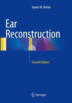 Ear Reconstruction - Avelar, Juarez M.