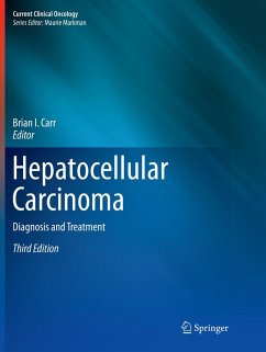 Hepatocellular Carcinoma