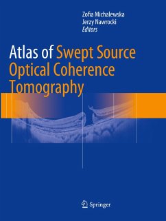 Atlas of Swept Source Optical Coherence Tomography