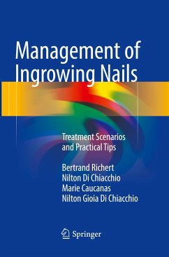 Management of Ingrowing Nails - Richert, Bertrand;Di Chiacchio, Nilton;Caucanas, Marie