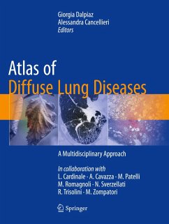 Atlas of Diffuse Lung Diseases