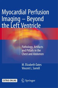 Myocardial Perfusion Imaging - Beyond the Left Ventricle - Oates, M. Elizabeth;Sorrell, Vincent L.