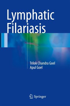Lymphatic Filariasis - Goel, Trilok Chandra;Goel, Apul