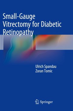 Small-Gauge Vitrectomy for Diabetic Retinopathy - Spandau, Ulrich