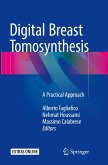 Digital Breast Tomosynthesis