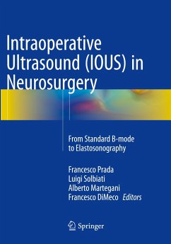 Intraoperative Ultrasound (IOUS) in Neurosurgery