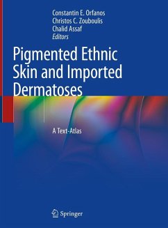 Pigmented Ethnic Skin and Imported Dermatoses (eBook, PDF)