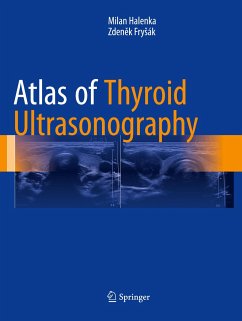 Atlas of Thyroid Ultrasonography - Halenka, Milan;Frysák, Zdenek