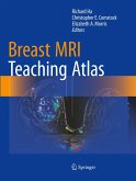 Breast MRI Teaching Atlas