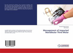 Management of Impacted Mandibular Third Molar