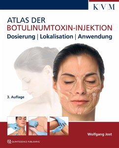 Atlas der Botulinumtoxin-Injektion - Jost, Wolfgang