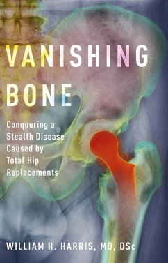 Vanishing Bone (eBook, ePUB) - Harris, William H. MD