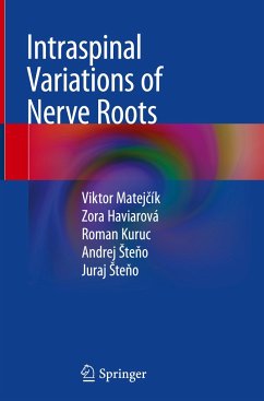 Intraspinal Variations of Nerve Roots - Matejcík, Viktor;Haviarová, Zora;Kuruc, Roman