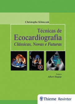 Técnicas de Ecocardiografia (eBook, ePUB) - Klimczak, Christophe