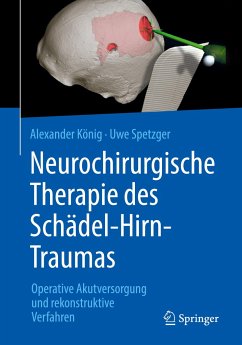 Neurochirurgische Therapie des Schädel-Hirn-Traumas - König, Alexander;Spetzger, Uwe