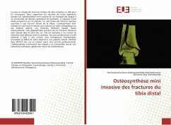 Ostéosynthèse mini invasive des fractures du tibia distal - Rohimpitiavana, Hanitrankasitrahana Amboarasarobidy;Ratsimbazafy, Johannes Seta