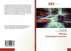 IRM des Cholangiocarcinomes - Toumi Kallel, Nozha;Harbi, Houssem;Ben Mahfoudh, Kheireddine