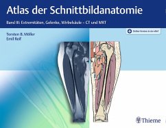 Atlas der Schnittbildanatomie (eBook, PDF) - Möller, Torsten Bert; Reif, Emil