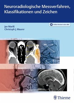 Neuroradiologische Messverfahren, Klassifikationen und Zeichen (eBook, ePUB) - Mariß, Jan; Maurer, Christoph J.