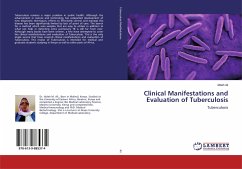 Clinical Manifestations and Evaluation of Tuberculosis