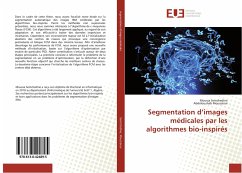 Segmentation d¿images médicales par les algorithmes bio-inspirés - Semchedine, Moussa;Moussaoui, Abdelouahab