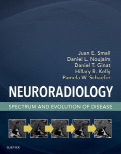 Cover Neuroradiology (eBook, ePUB)