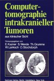 Computertomographie intrakranieller Tumoren aus klinischer Sicht (eBook, PDF)
