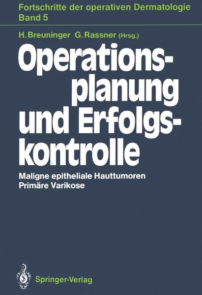 Operationsplanung und Erfolgskontrolle (eBook, PDF)