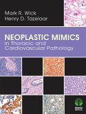 Neoplastic Mimics in Thoracic and Cardiovascular Pathology (eBook, ePUB)