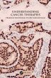 Understanding Cancer Therapies (eBook,... - Bild 1