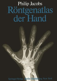Röntgenatlas der Hand (eBook, PDF) - Jacobs, P.
