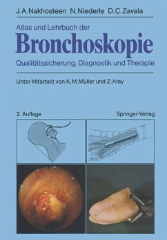 Atlas und Lehrbuch der Bronchoskopie (eBook, PDF) - Nakhosteen, John A.; Niederle, Norbert; Zavala, Donald C.