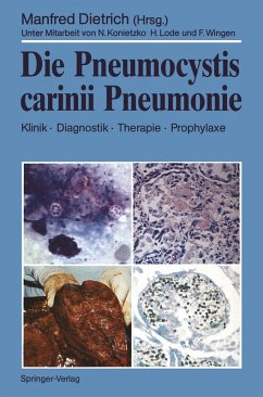 Cover Die Pneumocystis carinii Pneumonie (eBook, PDF)