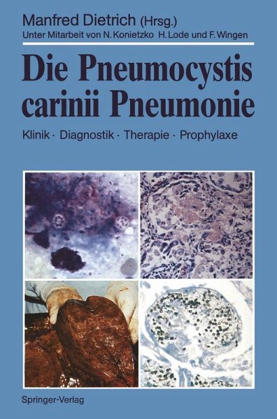 Die Pneumocystis carinii Pneumonie (eBook, PDF) Die Pneumocystis carinii Pneumonie (eBook, PDF)