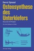 Osteosynthese des Unterkiefers (eBook, PDF)