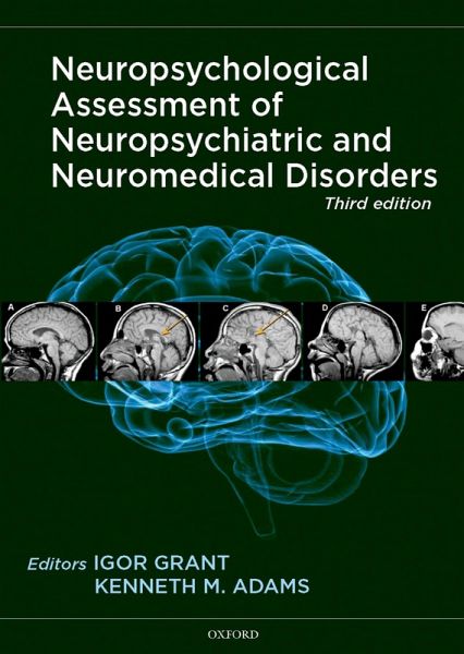 Neuropsychological Assessment of Neuropsychiatric and Neuromedical Disorders (eBook, PDF) Neuropsychological Assessment of Neuropsychiatric and Neuromedical Disorders (eBook, PDF)